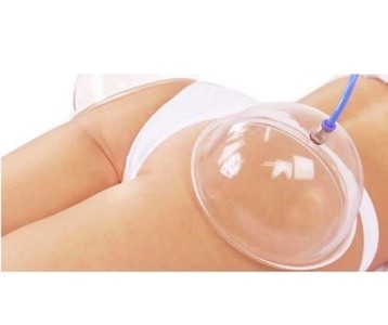 Up to 81% Off on Ultrasonic Fat Reduction at The Sculpt Shop
