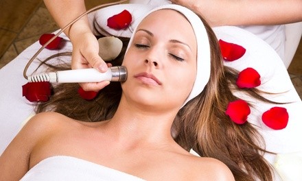 One or Two Microdermabrasion Treatments at Laser Loft (Up to 69% Off)