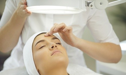 One Microneedling Session at Victory Wellness & Medspa (Up to 50% Off)