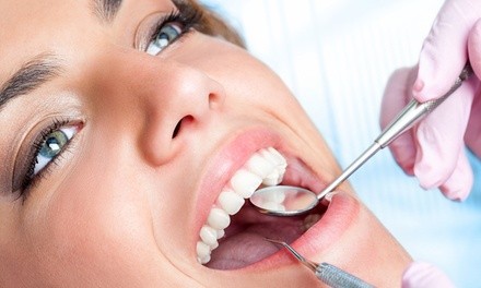 Up to 34% Off on Teeth Whitening - In-Office - Branded (Zoom, Brite Smile) at Rare Beauty