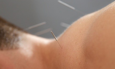 Infertility Treatment with Acupuncture-Initial Medical Intake and Two or Three Treatments (Up to 52% Off)