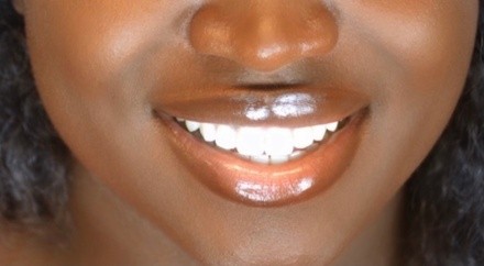 Up to 49% Off on Teeth Whitening - In-Office - Non-Branded at Grand Re-Creations