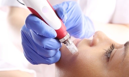 Up to 11% Off on Micro-Needling at Desert Permanent Make-Up