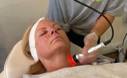 Up to 20% Off on Radio Frequency Skin Tightening at Skin Craze