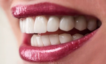 One 30- or 60-Minute Zoom! Teeth-Whitening Treatment at Cosmo Med Spa & Salon (Up to 80% Off)