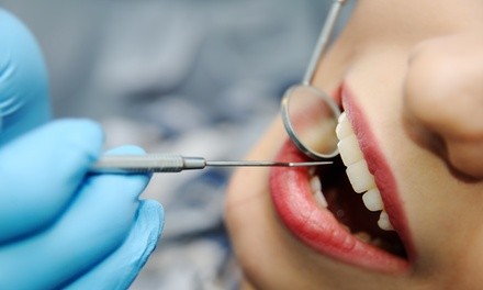  Up to 60% Off a Friday or Saturday Dental Cleaning at Share Dentistry!