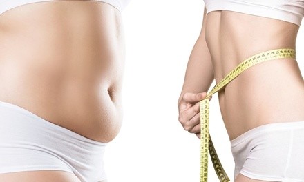 Up to 33% Off on Fat / Cellulite Reduction - Non-Branded at APMI Wellness Center