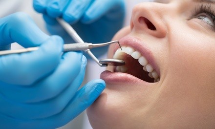Up to 78% Off on Dental Checkup at MY Dentists