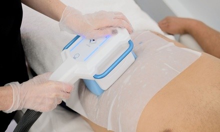Up to 30% Off Fat Freezing at Luxe Body Sculpts