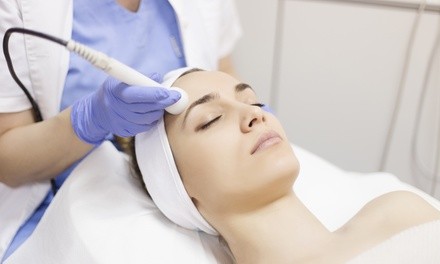 $100 for Crystal Microdermabrasion Treatment at Smile-Chic $210 Value)