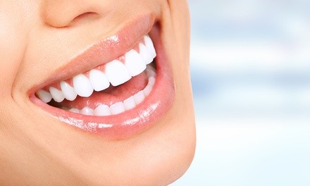 $349 for One 60-Minute In-Office Teeth-Whitening Treatment at Smile-Chic ($495 Value)