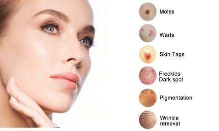 Up to 50% Off on Mole / Growth Removal at Lynn Studio