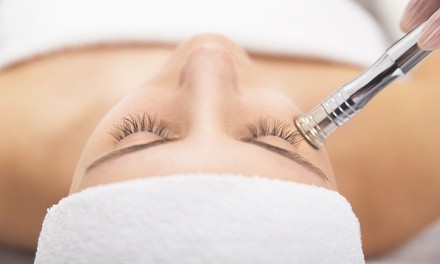 One or Two Microdermabrasion Treatments at Up Close Skin Care (Up to 44% Off)