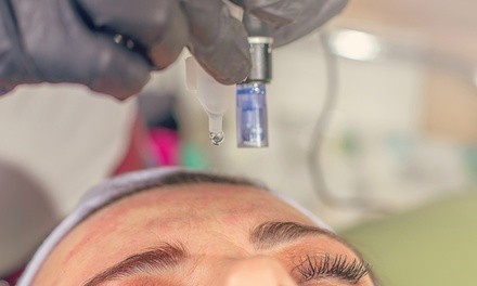 One or Two Microneedling Treatments at Phoenix Beauty (Up to 57% Off)