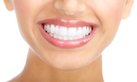 Up to 84% Off on Dental Checkup (Cleaning, X-Ray, Exam) at Patuxent River Dental Care