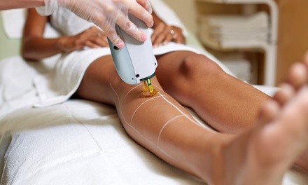 Up to 68% Off on Laser Hair Removal at Eye Candy Rejuvenation Center