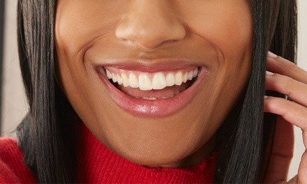 60- or 80-Minute Teeth-Whitening Session or  5-Minute Teeth-Whitening Foam Bath (Up to 30% Off)