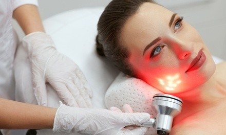 One HIFU Session for Under Eye or Nasal Fold at Burnt Hills Laser (Up to 61% Off)