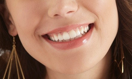 Teeth Whitening or Self-Care Hour at Forte Survie Body Contouring (Up to 30% Off). 5 Options Available.