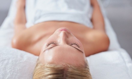 Up to 61% Off on Microdermabrasion at The Hue Solution