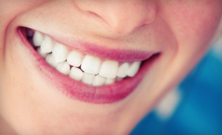 One or Two BleachBright Teeth-Whitening Treatments at Pacific Tanning (Up to 85% Off)