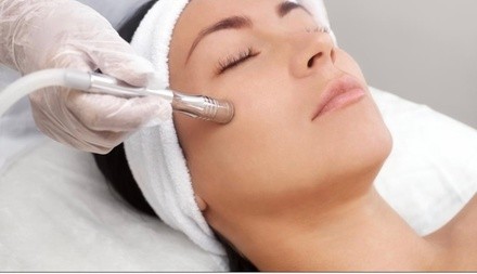 Up to 60% Off on Microdermabrasion at Katelins Wax Co