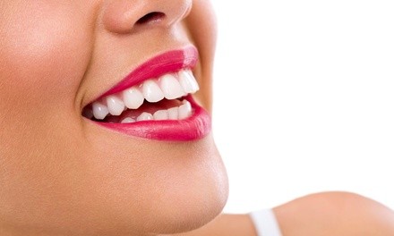 30- or 60-Minute In-Office Teeth Whitening Treatment at B More Bodied (Up to 33% Off)