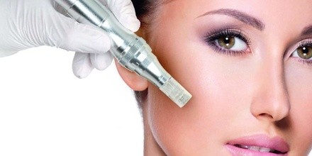 Up to 50% Off on Micro-Needling at Beauty Fix Aesthetics & Wellness