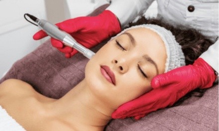 Up to 75% Off on Micro-Needling at Prima Medical Spa