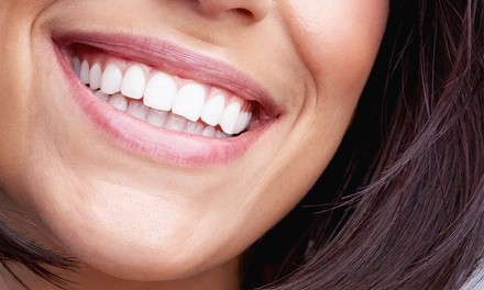 Up to 46% Off on Teeth Whitening at Gracefully Touched Beauty & Selfie Studio