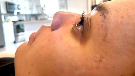 Up to 41% Off on HydraFacial at Luna Koi