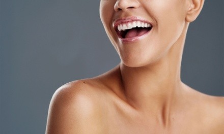 Up to 63% Off on Teeth Whitening - In-Office - Branded (Beyond, Power) at Epic-White