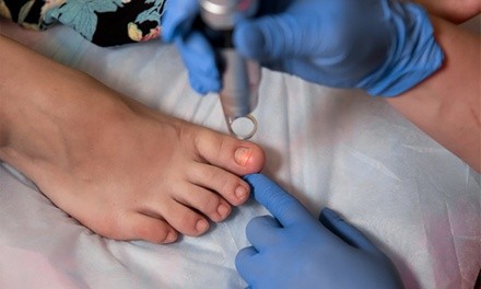 Up to 63% Off on Toe Fungus Treatment at NWALasers Aesthetics at TruHealth