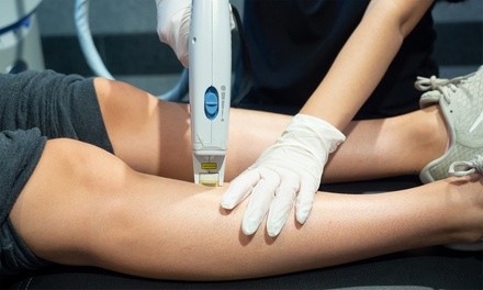 Two or Four Laser Spider-Vein Removal Sessions at Couture Med Spa (Up to 63% Off)