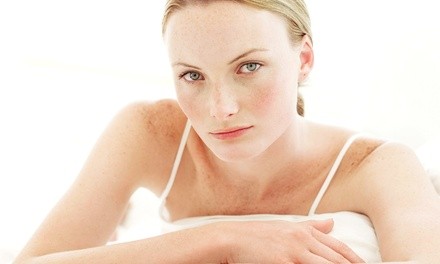 One, Two, or Three Skin-Tightening Lifts at Skin Body Lounge in Studio City (Up to 65% Off)