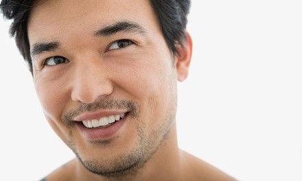 20 or 40 Units of Botox at Uptown Med Spa (Up to 33% Off)