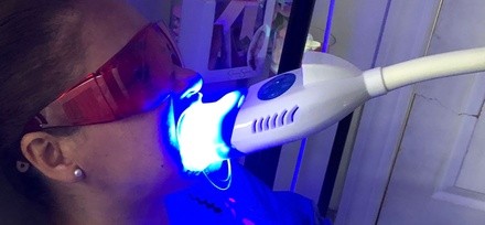 Up to 10% Off on Teeth Whitening at Sonrisa Blanca