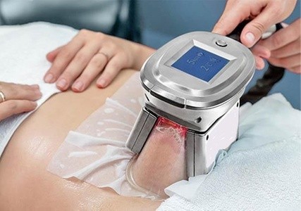 Up to 80% Off on Fat / Cellulite Reduction - Non-Branded at Valentina's Beauty Rejuvenation and Wellness