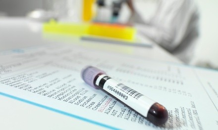 Up to 67% Off on Blood Testing at Altruistic Health & Wellness