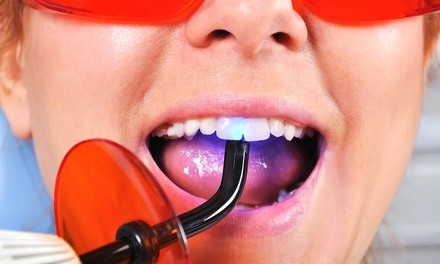 Up to 30% Off on Teeth Whitening - In-Office - Non-Branded at LPBeauty_andbody