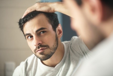 Up to 56% Off on Hair Restoration - Non-Surgical at NU Age Aesthetics