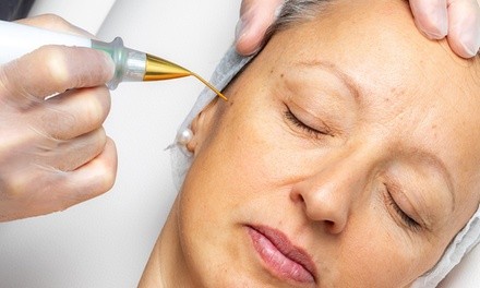 Plasma Fibroblast Treatment for Forehead Lines or Full Eye Lift at About Face Esthetics (Up to 60% Off)