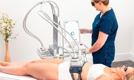 One or Three Venus Bliss Laser Lipo Sessions at Ultra Body Sculpt (Up to 85% Off)