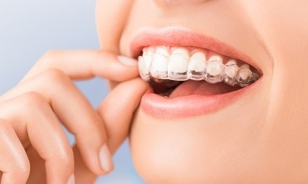 Up to 86% Off on Invisalign at Tower Dental Arts