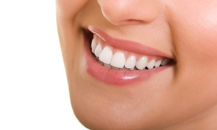 $12 for $1,500 Toward Invisalign Treatment at SouthEnd Dentistry