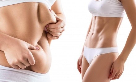 Body-Sculpting or Ultracavitation Treatments at Annusca Aesthetics (Up to 45% Off). Four Options Available.