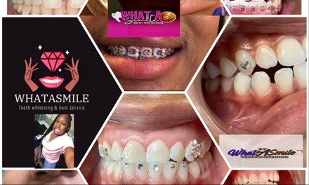Up to 50% Off on Teeth Whitening at WhatASmile