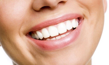 Up to 52% Off on LED and Infrared Natural Teeth Whitening at Sunless Beauty -
Organic Spray Tanning