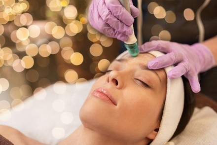 Up to 53% Off on Micro-Needling at Delicious Spa