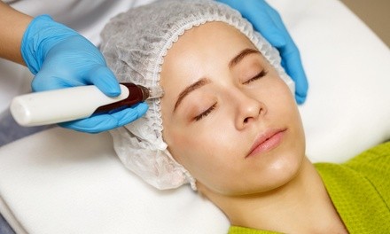 One or Two Microneedling Sessions at PurAesthetics Rejuvenation & Wellness (Up to 40% Off)